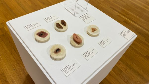 Photographie moderne d'une vitrine montrant plusieurs prothèses oculaires.