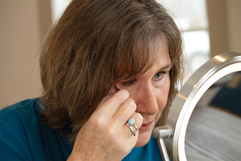 Modern photograph of a middle-aged white woman with brown hair looking into a lighted mirror, applying an eye prosthesis to her right eye