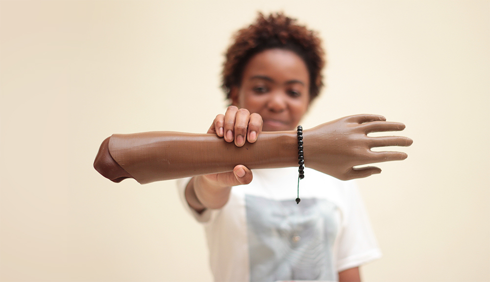 Modern photograph of a young Black person with short curly hair holding an artificial hand and forearm out to the viewer