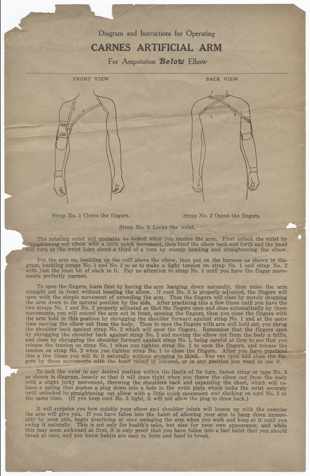Scan of a vintage page printed with two illustrations of a human figure wearing an artificial arm plus dense paragraphs of printed text.
