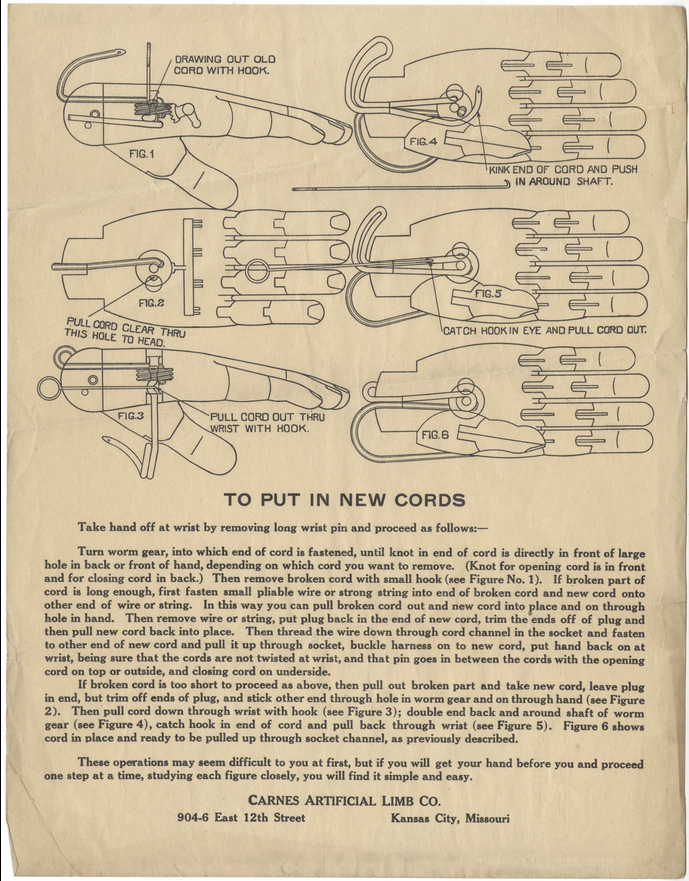 Scan of a vintage document with diagrams of an artificial hand from different angles and paragraphs of dense text.