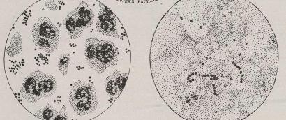 Scan of a page with printed diagrams of microbe cultures under a microscope.